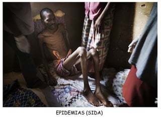 EPIDEMIAS (SIDA)

 