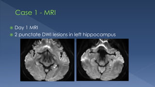  Day 1 MRI
 2 punctate DWI lesions in left hippocampus
 