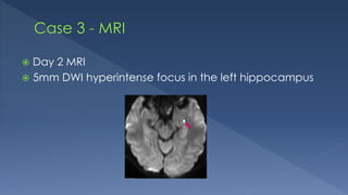  Day 2 MRI
 5mm DWI hyperintense focus in the left hippocampus
 