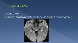  Day 2 MRI
 4.5mm DWI hyperintense focus in the left hippocampus
 