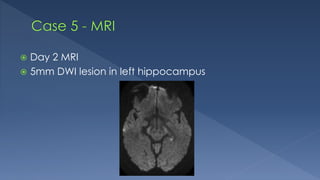  Day 2 MRI
 5mm DWI lesion in left hippocampus
 