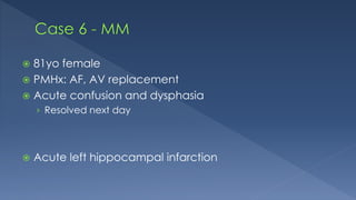  81yo female
 PMHx: AF, AV replacement
 Acute confusion and dysphasia
› Resolved next day
 Acute left hippocampal infarction
 