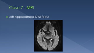  Left hippocampal DWI focus
 