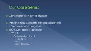  Consistent with other studies
 MRI findings supports clinical diagnosis
› Treatment and prognosis
 100% MRI detection rate
› Why?
 Optimised protocol
 t = 24-72 hrs
 b = 2000
 3mm thick slices
 
