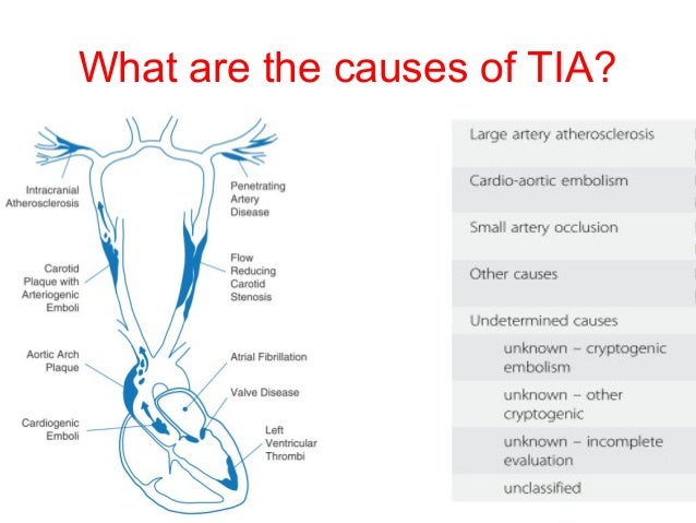 what are symptoms of a tia attack what are symptoms of a tia attack