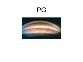 PG
 
