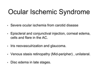 Ocular Ischemic Syndrome
• Severe ocular ischemia from carotid disease
• Episcleral and conjunctival injection, corneal edema,
cells and flare in the AC.
• Iris neovasculrization and glaucoma.
• Venous stasis retinopathy (Mid-peripher) , unilateral.
• Disc edema in late stages.
 