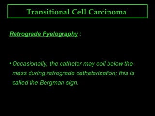 Transitional cell carcinoma | PPT