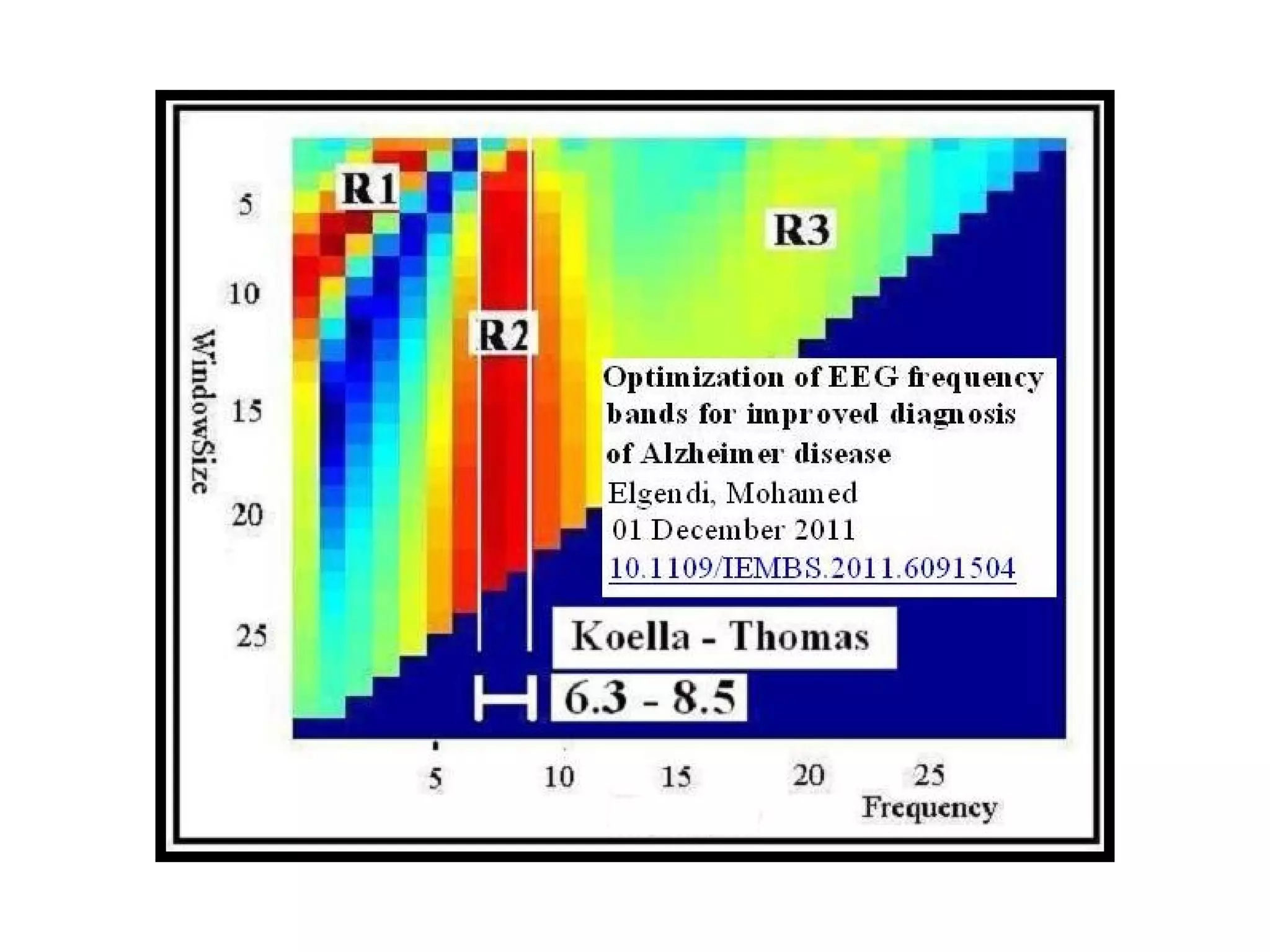 Transition state theory   eeg alpha rhythm
