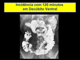 Incidência com 120 minutos  em Decúbito Ventral 