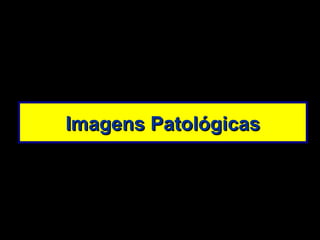 Imagens Patológicas 