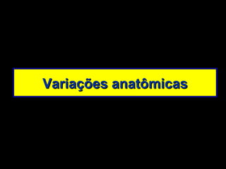 Variações anatômicas 
