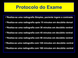 Protocolo do Exame Realiza-se uma radiografia Simples, paciente ingere o contraste Realiza-se uma radiografia após 15 minutos em decúbito dorsal Realiza-se uma radiografia com 30 minutos em decúbito ventral Realiza-se uma radiografia com 45 minutos em decúbito ventral Realiza-se uma radiografia com 90 minutos em decúbito ventral Realiza-se uma radiografia com 120 minutos em decúbito ventral Realiza-se uma radiografia com 180 minutos em decúbito ventral 