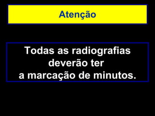 Atenção Todas as radiografias deverão ter  a marcação de minutos. 
