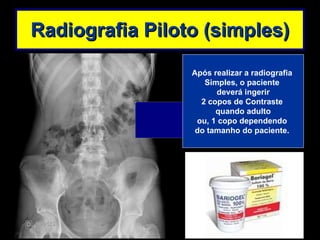 Radiografia Piloto (simples) Após realizar a radiografia  Simples, o paciente  deverá ingerir 2 copos de Contraste  quando adulto ou, 1 copo dependendo  do tamanho do paciente.  