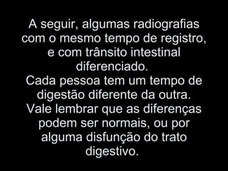 A seguir, algumas radiografias com o mesmo tempo de registro, e com trânsito intestinal diferenciado.  Cada pessoa tem um tempo de digestão diferente da outra. Vale lembrar que as diferenças podem ser normais, ou por alguma disfunção do trato digestivo.  