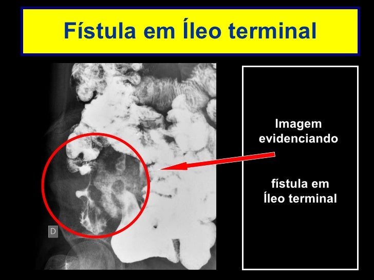 Transito intestinal exame