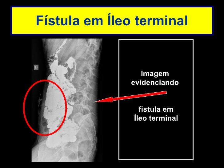 Transito intestinal exame