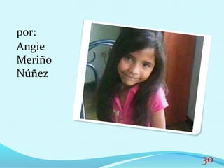 por:
Angie
Meriño
Núñez
30
 