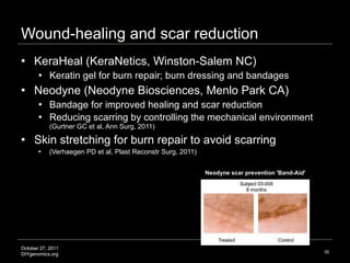 Wound-healing and scar reduction KeraHeal (KeraNetics, Winston-Salem NC) Keratin gel for burn repair; burn dressing and bandages Neodyne (Neodyne Biosciences, Menlo Park CA) Bandage for improved healing and scar reduction Reducing scarring by controlling the mechanical environment  (Gurtner GC et al, Ann Surg, 2011) Skin stretching for burn repair to avoid scarring  (Verhaegen PD et al, Plast Reconstr Surg, 2011) Neodyne scar prevention 'Band-Aid' Image credit: http://www.internalmedicinenews.com 