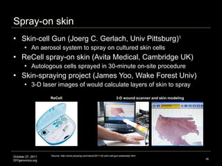 Spray-on skin  Skin-cell Gun (Joerg C. Gerlach, Univ Pittsburg) 1 An aerosol system to spray on cultured skin cells ReCell spray-on skin (Avita Medical, Cambridge UK) Autologous cells sprayed in 30-minute on-site procedure  Skin-spraying project (James Yoo, Wake Forest Univ) 3-D laser images of would calculate layers of skin to spray  1 Source: http://www.physorg.com/news/2011-02-skin-cell-gun-drastically.html Image credit: http://www.avitamedical.com ReCell Image credit: http://inhabitat.com/skin-cell-spraying-bio-printer-can-heal-burn-victims-in-three-weeks 3-D wound scanner and skin modeling 