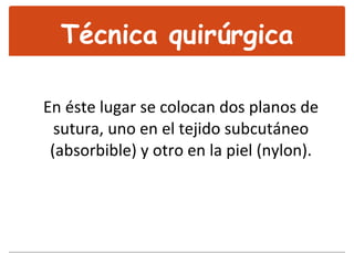 En éste lugar se colocan dos planos de sutura, uno en el tejido subcutáneo (absorbible) y otro en la piel (nylon). Técnica quirúrgica 