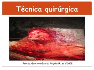 Técnica quirúrgica Fuente: Guerrero García, Avigdor R.,  et al  2009. 