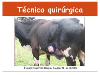 Técnica quirúrgica Fuente: Guerrero García, Avigdor R.,  et al  2009. 