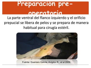 Preparación pre-operatoria La parte ventral del flanco izquierdo y el orificio prepucial se libera de pelos y se prepara de manera habitual para cirugía estéril. Fuente: Guerrero García, Avigdor R.,  et al  2009. 