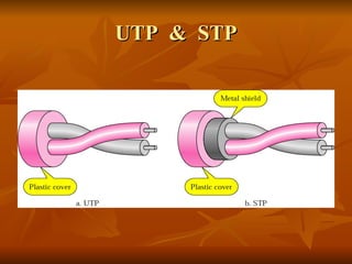 UTP  &  STP 