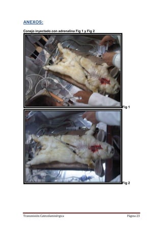 Transmisión Catecolaminérgica Página 23
ANEXOS:
Conejo inyectado con adrenalina Fig 1 y Fig 2
Fig 1
Fig 2
 
