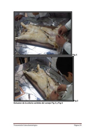 Transmisión Catecolaminérgica Página 24
Fig 3
Fig 2
Oclusion de la arteria carótida del conejo Fig 3 y Fig 4
 