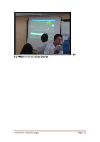 Transmisión Catecolaminérgica Página 26
FIg 7
Fig 7Monitoreo en oclusión arterial
 