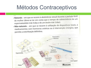 Métodos Contraceptivos
 
