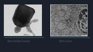 Zinc Oxide Crystal Rat’s Liver
 