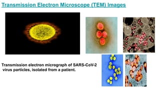 TRANSMISSION ELECTRON MICROSCOPY ( TEM ) | PDF