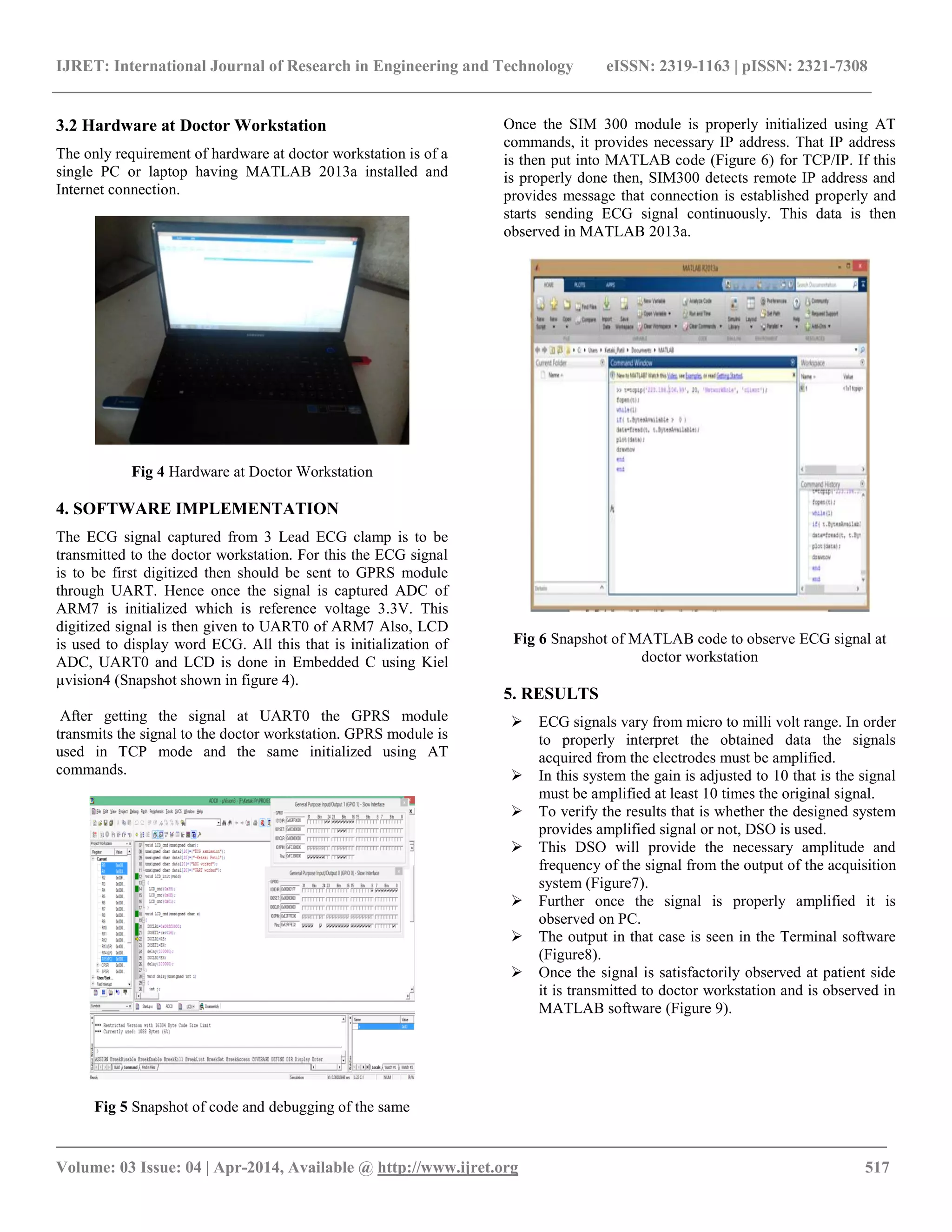 IJRET: International Journal of Research in Engineering and Technology eISSN: 2319-1163 | pISSN: 2321-7308
_________________________________________________________________________________________
Volume: 03 Issue: 04 | Apr-2014, Available @ http://www.ijret.org 517
3.2 Hardware at Doctor Workstation
The only requirement of hardware at doctor workstation is of a
single PC or laptop having MATLAB 2013a installed and
Internet connection.
Fig 4 Hardware at Doctor Workstation
4. SOFTWARE IMPLEMENTATION
The ECG signal captured from 3 Lead ECG clamp is to be
transmitted to the doctor workstation. For this the ECG signal
is to be first digitized then should be sent to GPRS module
through UART. Hence once the signal is captured ADC of
ARM7 is initialized which is reference voltage 3.3V. This
digitized signal is then given to UART0 of ARM7 Also, LCD
is used to display word ECG. All this that is initialization of
ADC, UART0 and LCD is done in Embedded C using Kiel
µvision4 (Snapshot shown in figure 4).
After getting the signal at UART0 the GPRS module
transmits the signal to the doctor workstation. GPRS module is
used in TCP mode and the same initialized using AT
commands.
Fig 5 Snapshot of code and debugging of the same
Once the SIM 300 module is properly initialized using AT
commands, it provides necessary IP address. That IP address
is then put into MATLAB code (Figure 6) for TCP/IP. If this
is properly done then, SIM300 detects remote IP address and
provides message that connection is established properly and
starts sending ECG signal continuously. This data is then
observed in MATLAB 2013a.
Fig 6 Snapshot of MATLAB code to observe ECG signal at
doctor workstation
5. RESULTS
 ECG signals vary from micro to milli volt range. In order
to properly interpret the obtained data the signals
acquired from the electrodes must be amplified.
 In this system the gain is adjusted to 10 that is the signal
must be amplified at least 10 times the original signal.
 To verify the results that is whether the designed system
provides amplified signal or not, DSO is used.
 This DSO will provide the necessary amplitude and
frequency of the signal from the output of the acquisition
system (Figure7).
 Further once the signal is properly amplified it is
observed on PC.
 The output in that case is seen in the Terminal software
(Figure8).
 Once the signal is satisfactorily observed at patient side
it is transmitted to doctor workstation and is observed in
MATLAB software (Figure 9).
 