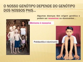 O NOSSO GENÓTIPO DEPENDE DO GENÓTIPO 
DOS NOSSOS PAIS… 
Algumas doenças têm origem genética e 
podem ser recessivas ou dominantes… 
Albinismo é recessiva 
Polidactilia é dominante 
 