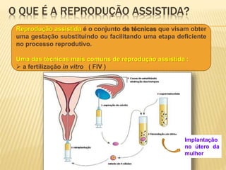 O QUE É A REPRODUÇÃO ASSISTIDA? 
Reprodução assistida é o conjunto de técnicas que visam obter 
uma gestação substituindo ou facilitando uma etapa deficiente 
no processo reprodutivo. 
Uma das técnicas mais comuns de reprodução assistida : 
 a fertilização in vitro ( FIV ) 
Implantação 
no útero da 
mulher 
 