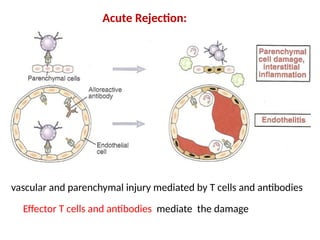 transplantation .pptx mechanisms of graft rejection | PPTX
