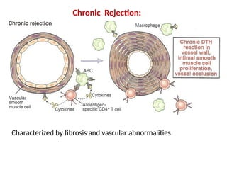 transplantation .pptx mechanisms of graft rejection | PPTX