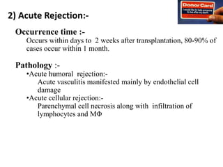 2) Acute Rejection:-
Occurrence time :-
Occurs within days to 2 weeks after transplantation, 80-90% of
cases occur within 1 month.
Pathology :-
•Acute humoral rejection:-
Acute vasculitis manifested mainly by endothelial cell
damage
•Acute cellular rejection:-
Parenchymal cell necrosis along with infiltration of
lymphocytes and MΦ
 