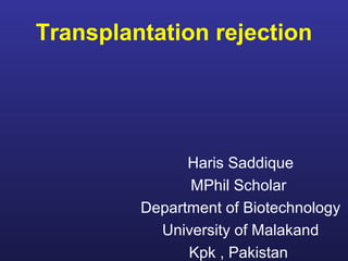 Transplantation Immunology

Haris Saddique
MPhil Scholar
Department of Biotechnology
University of Malakand
Kpk , Pakistan

 