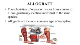 transplantation immunology: an overview.pptx