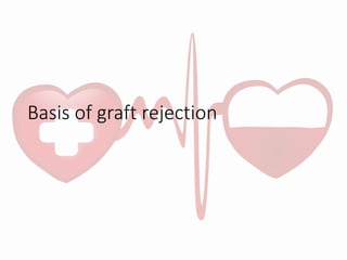 Basis of graft rejection
 