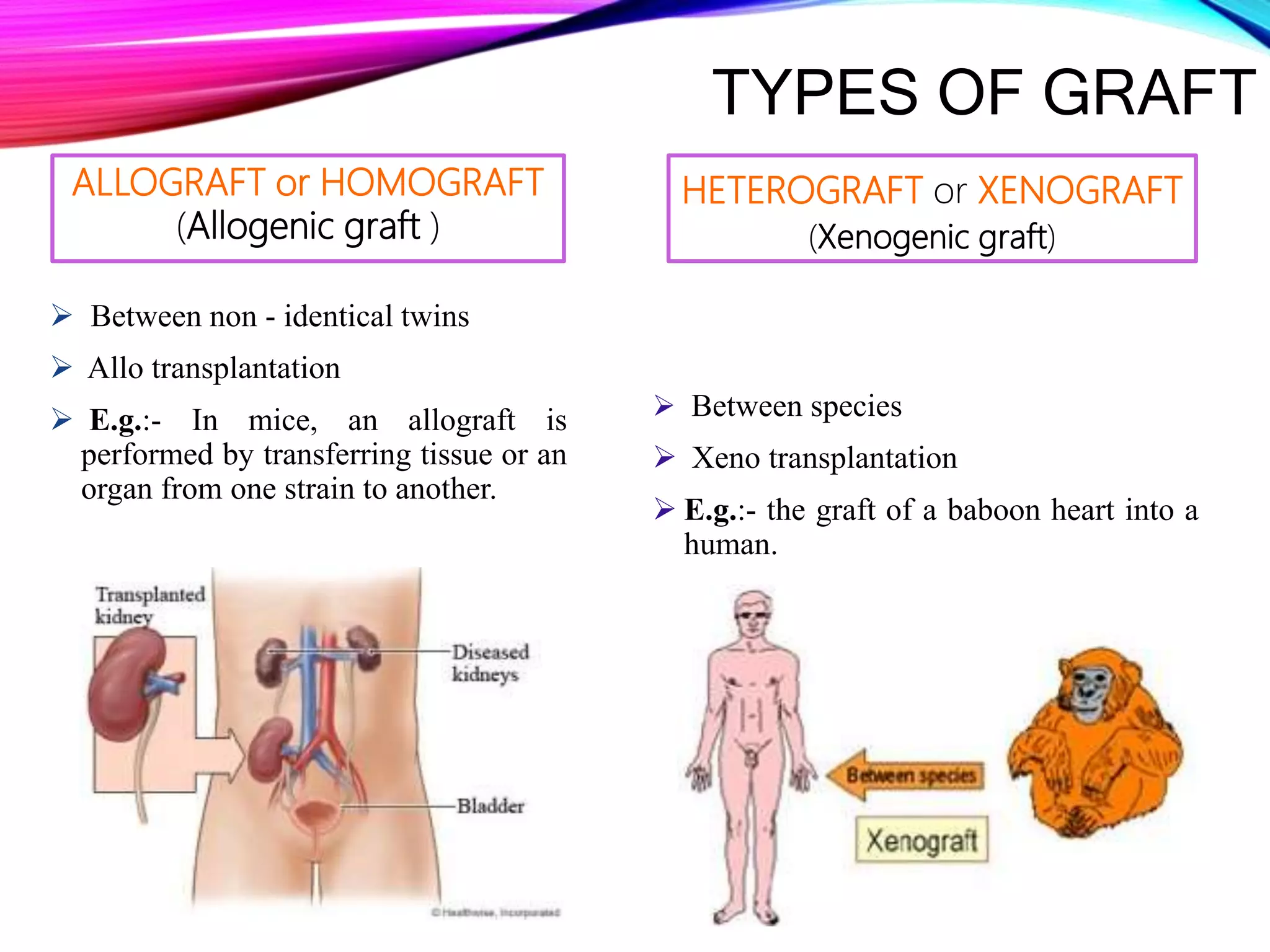Isograft Examples Transplantation | PPTX