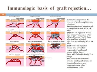Immunologic basis of graft rejection…
3/18/2024
13
 