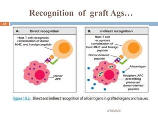 Recognition of graft Ags…
3/18/2024
24
 