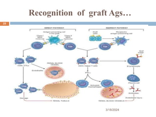 Recognition of graft Ags…
3/18/2024
25
 