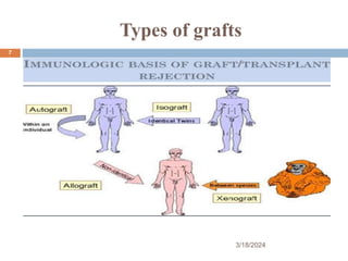 Types of grafts
3/18/2024
7
 